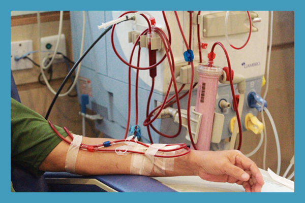 Dialysis Access